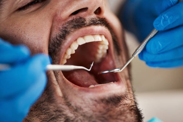Best Emergency Treatment for Dental Infections or Abscesses in Albany, OR