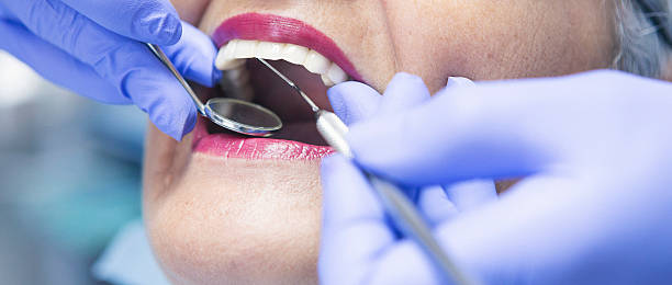 Best Emergency Dental Care for Broken or Chipped Teeth in Albany, OR